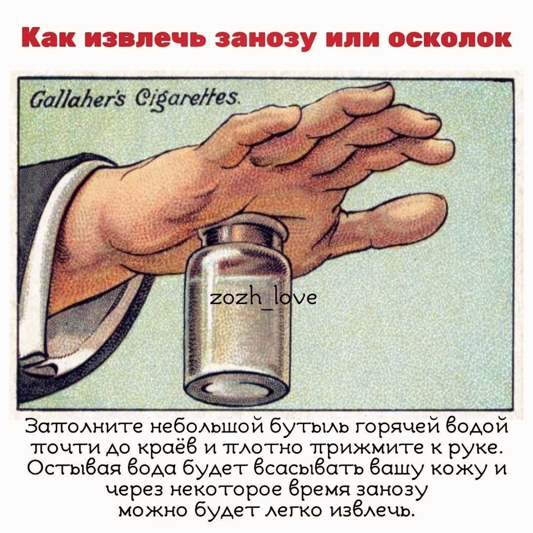 Как вытащить занозу из пальца, если она глубоко, из под ногтя, у ребенка иголкой